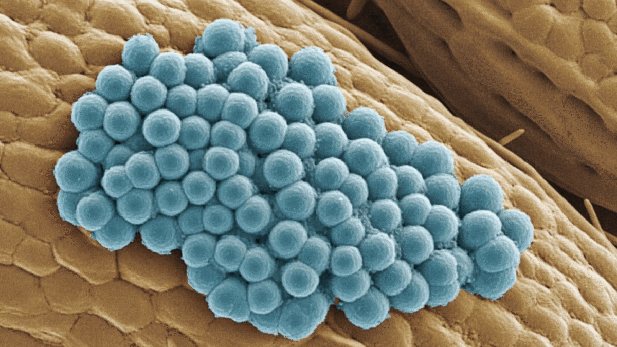 Hongos productores de micotoxinas en frutos secos almacenados